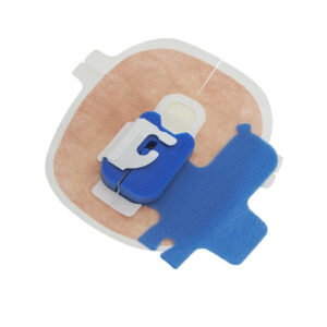 SKATER™ Fix Catheter Fixation Device | Argon Medical Devices